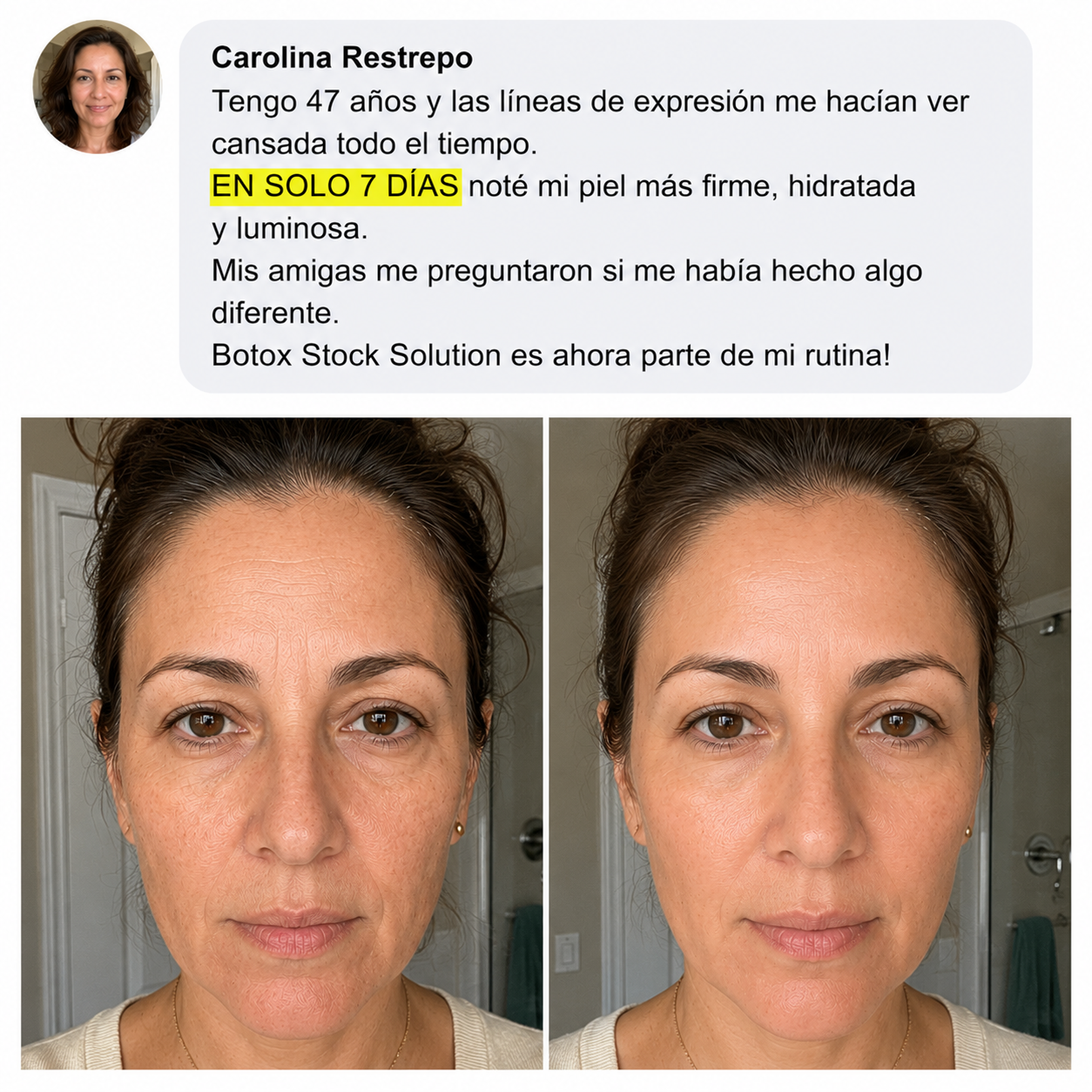 Antes y después - cliente real
