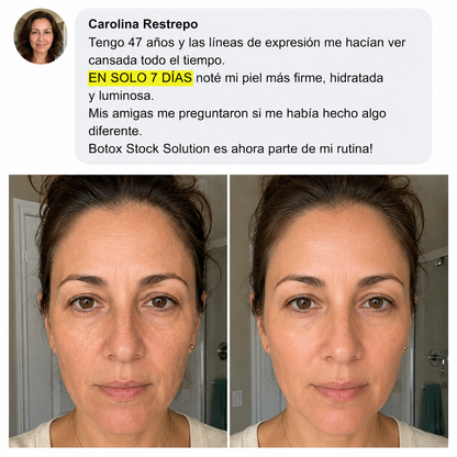 Antes y después - cliente real