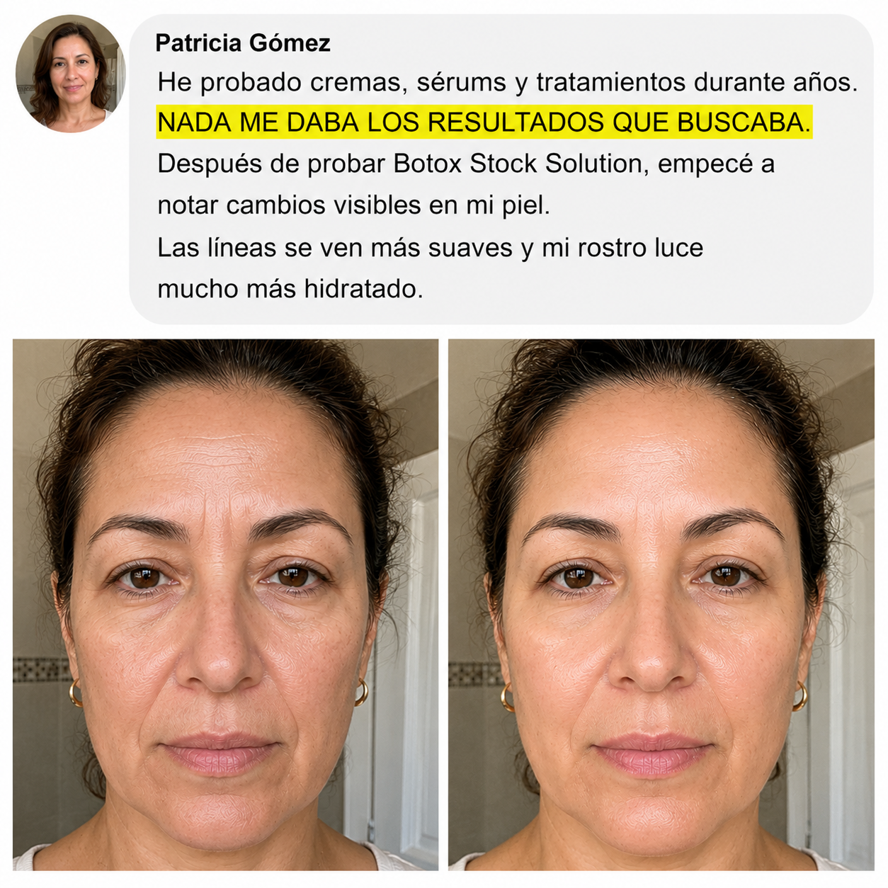 Antes y después - cliente real